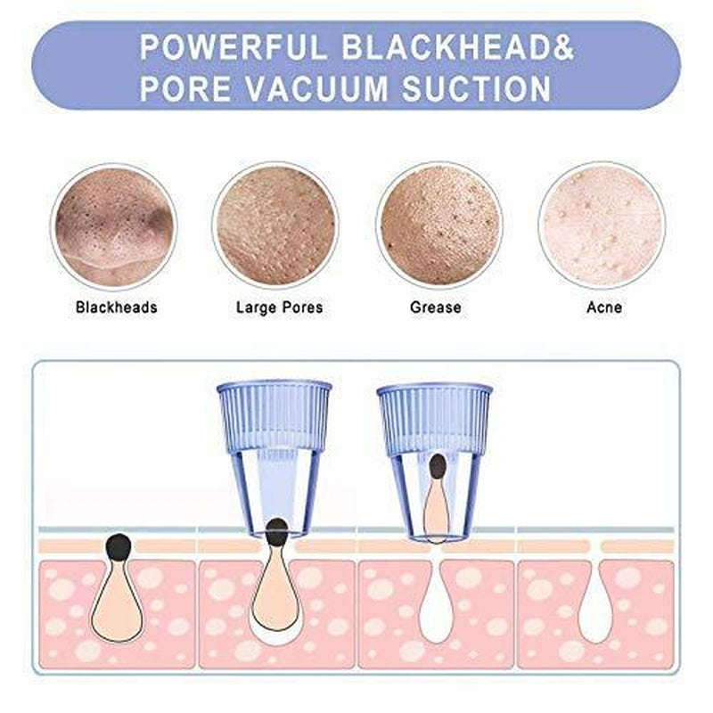 Brand New--Coofo Blackhead Remover Pore Vacuum Acne Whitehead Cleanser